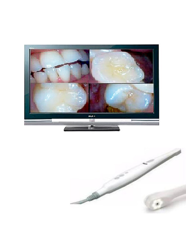 camara-intraoral