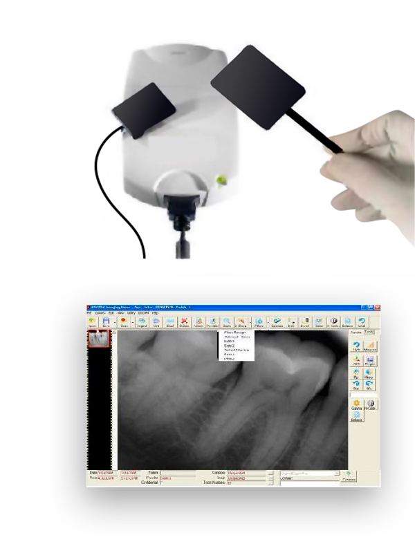 radiografia-digital